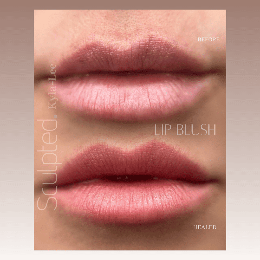 Before and after Lip Blush showing soft, healed lips with natural pink tone and even color at Kyla Paris Aesthetics.